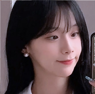 jaw main ba bottom before5m mo