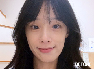 jaw main ba bottom before mo