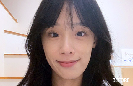 jaw main ba bottom before pc