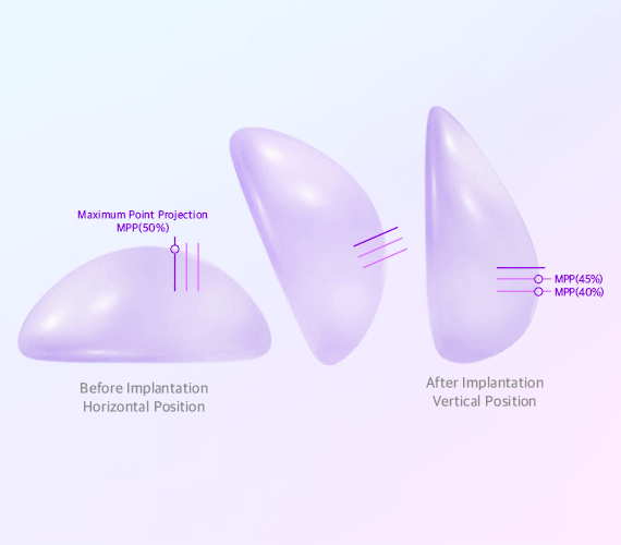 renewal section4 slide img1