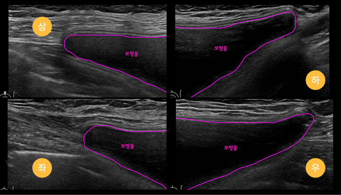 renewal section6 img2 mo