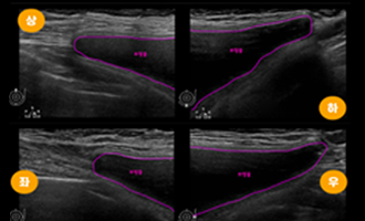 renewal section6 img2