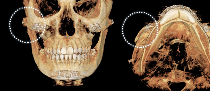 reoperation sec04 img4