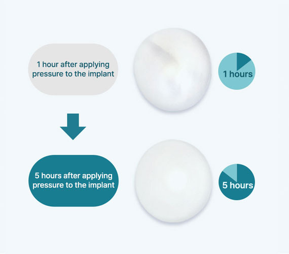 sebbin point img3 mo