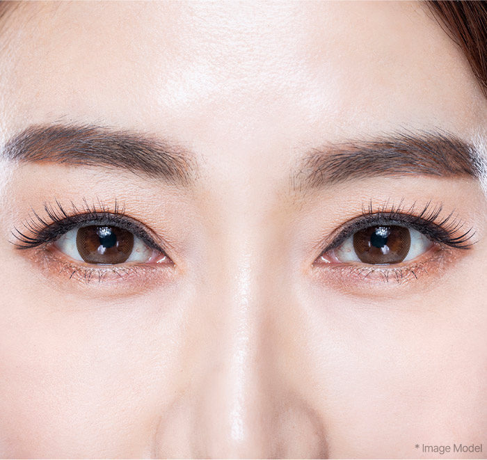 Sub Brow Lift 32 browlift slide 02 mo