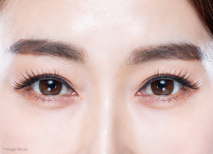 Sub Brow Lift 31 browlift slide 02 pc