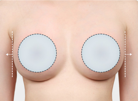 03. 크기/모양이 불만족인 경우