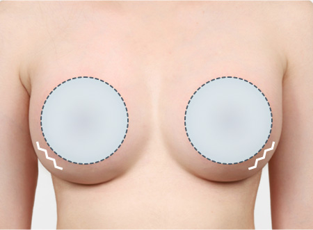 04. 리플링 현상