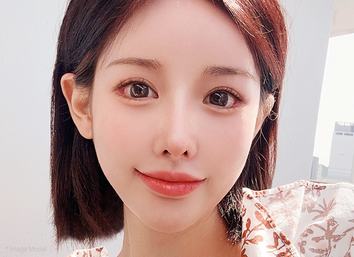 img canthoplasty2 pc