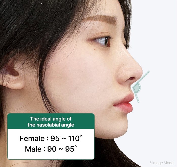 nose alar slide 01 mo