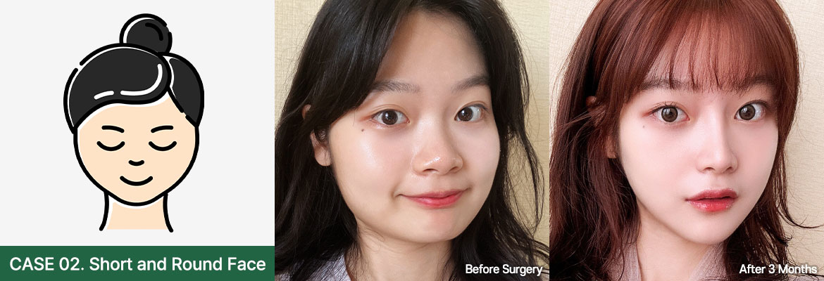 nose bfaf slide 02 pc