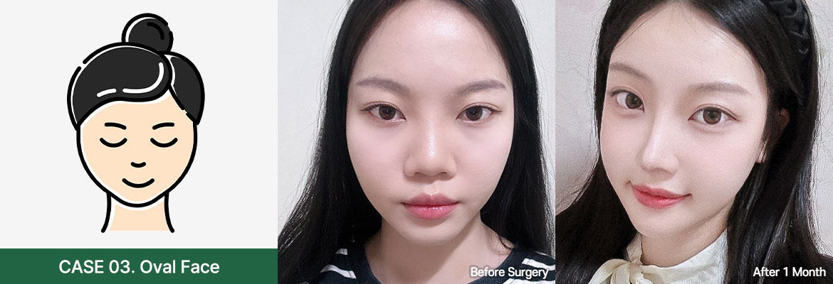 nose bfaf slide 03 pc