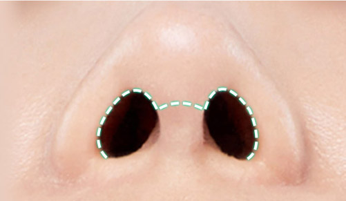 nose case 01 method2 01 mo