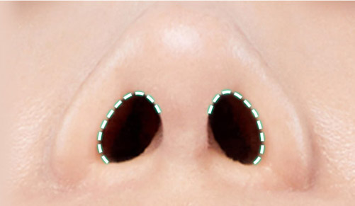 nose case 01 method2 02 mo