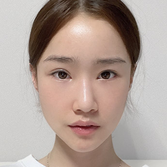 nose case 01 point 01