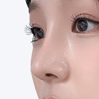 nose case 04 point 02