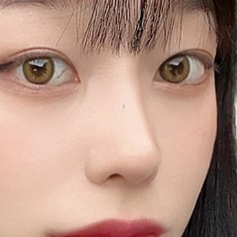 nose case 05 point 02