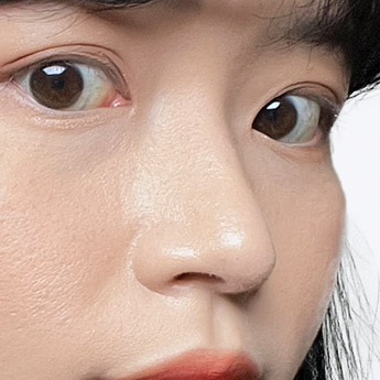 nose case 05 point 03