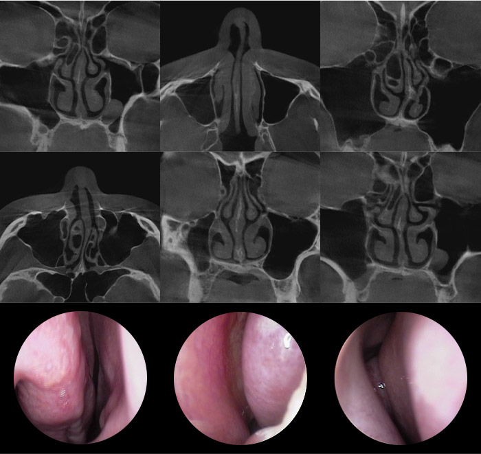 nose dev slider 02 mo