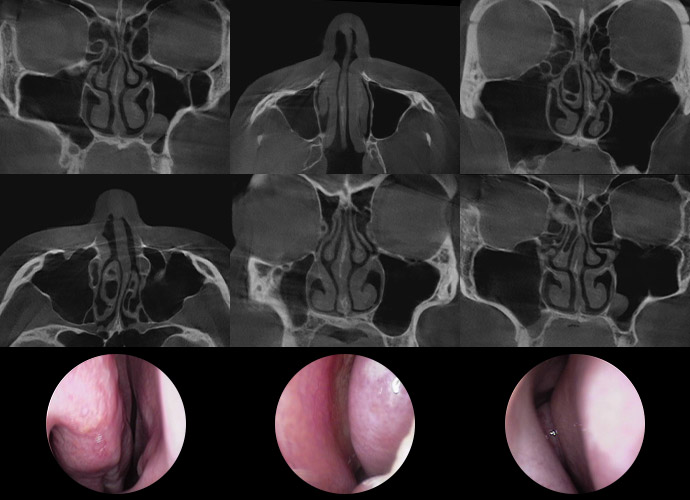 nose dev slider 02 pc