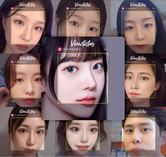 nose dev slider 04 mo