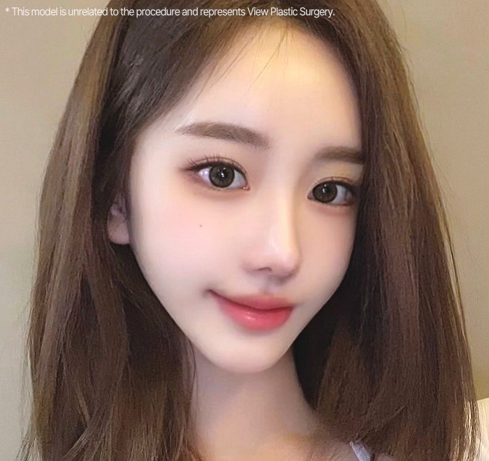 nose implants slider 03 mo