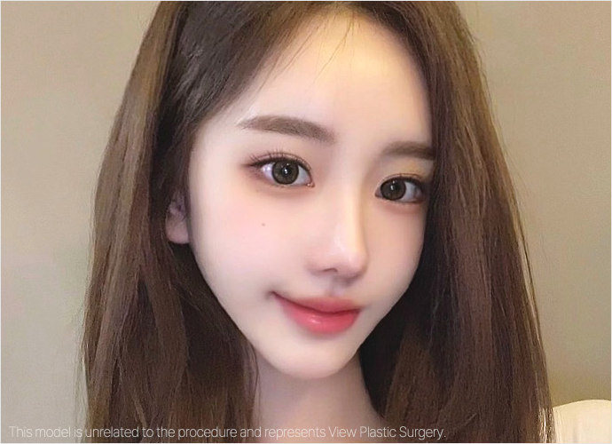 nose implants slider 03 pc