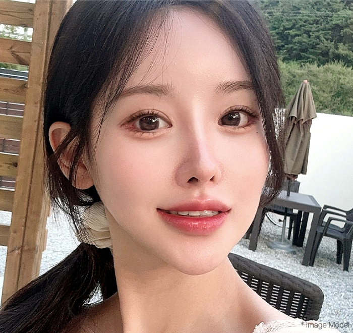 reoperation slide 1 mo