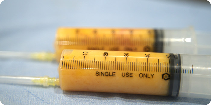 fat tab 03 img 01 mo