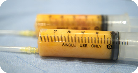 fat tab 03 img 01 pc