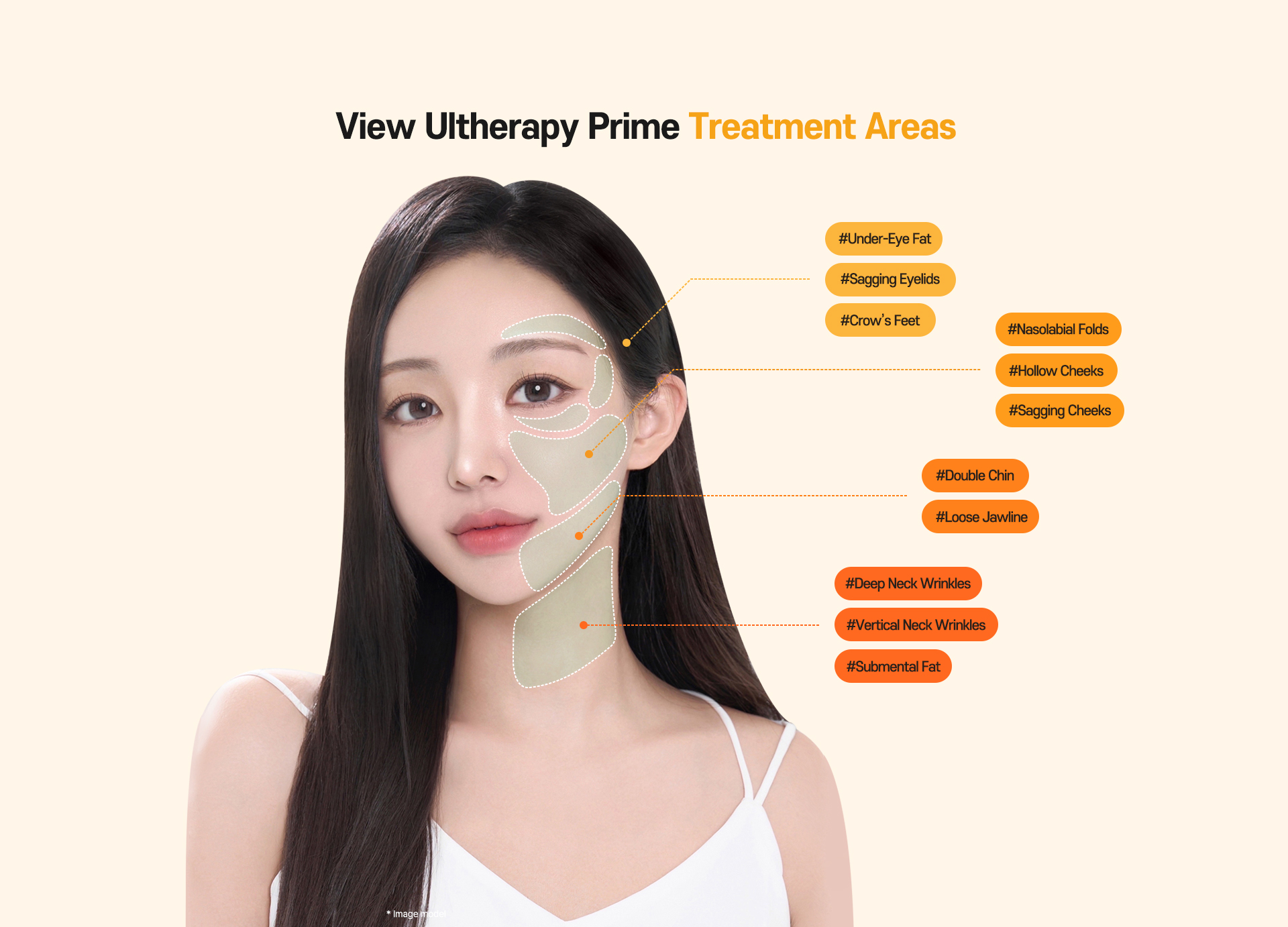 250326 usahome ulthera pc CASE 1