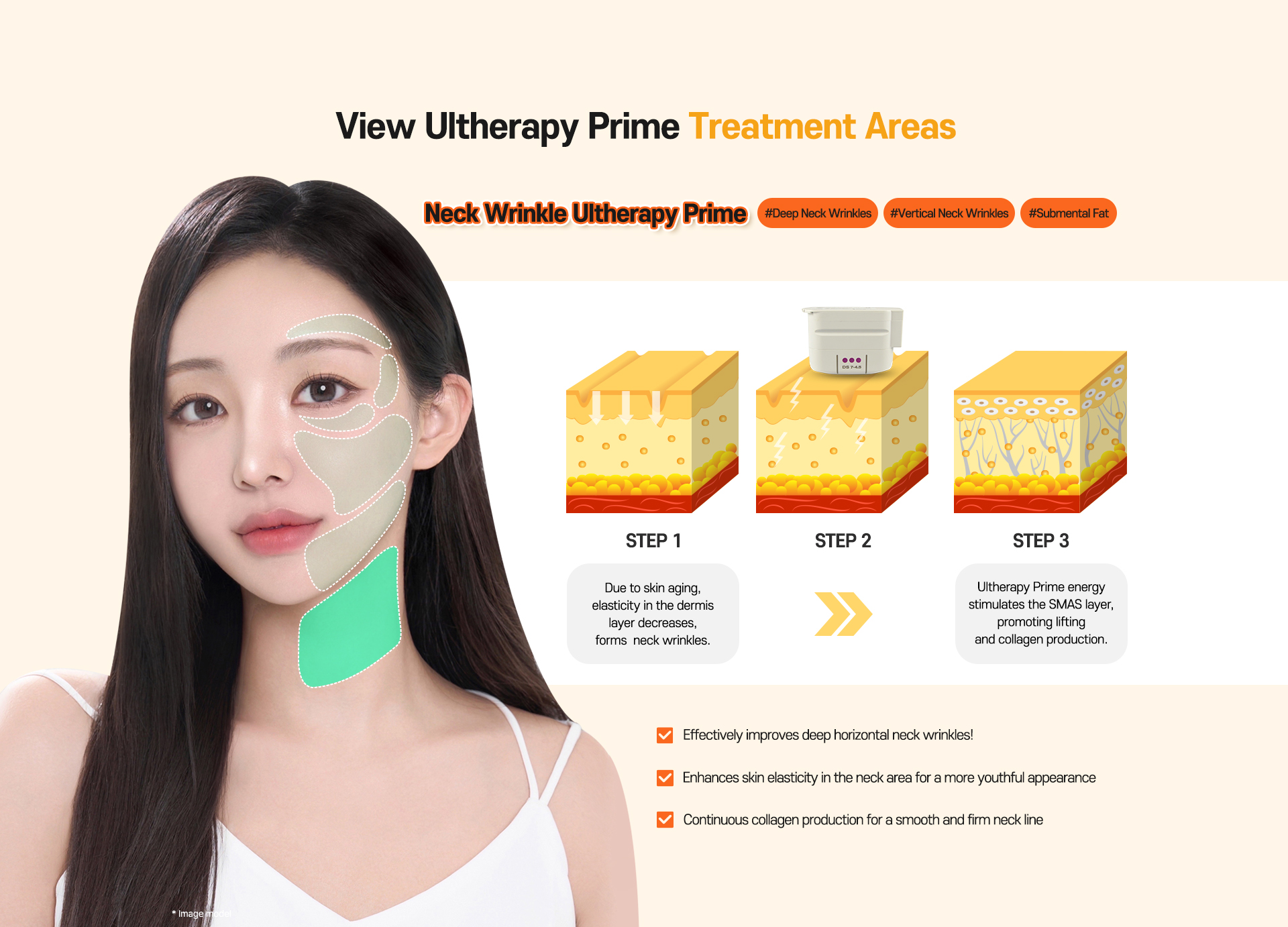 250326 usahome ulthera pc CASE 5