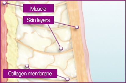 Sagging and stretched collagen 사진