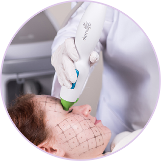 EYE 써마지FLX 사진