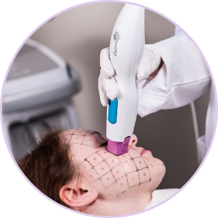 FACE 써마지FLX 사진