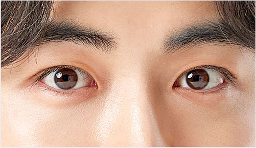 male eye diffrent 01 mo