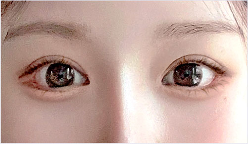 male eye diffrent 02 mo