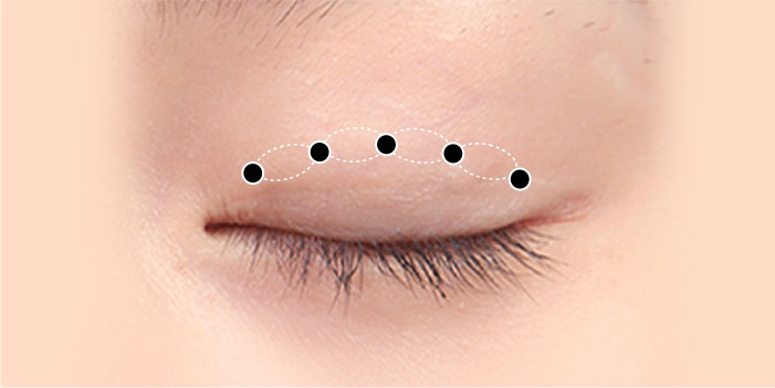 male eye method 01 02 mo