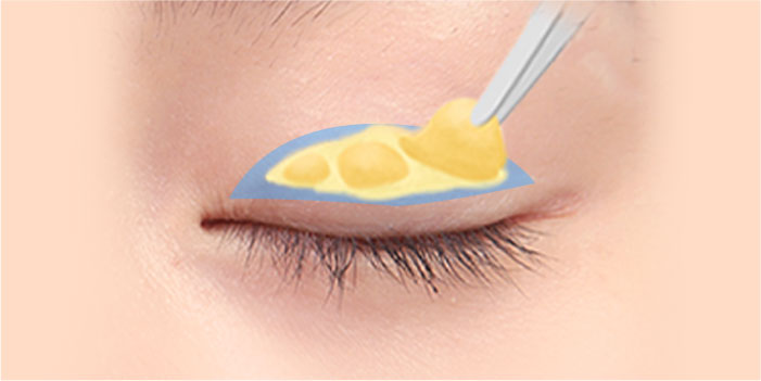 male eye method 02 01 mo