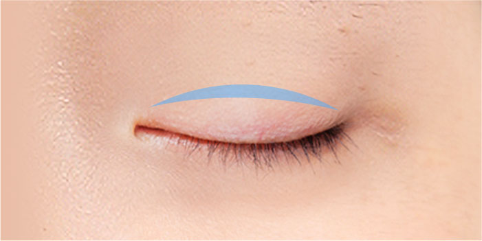 male eye method 04 01 mo