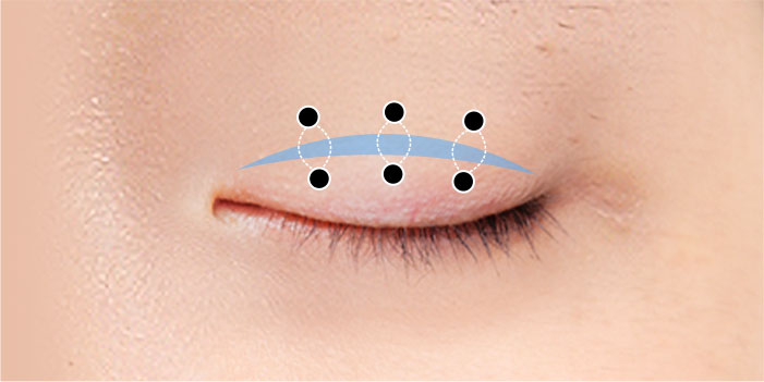 male eye method 04 02 mo