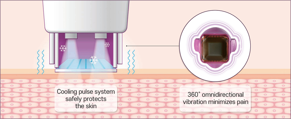 eXperience 이미지