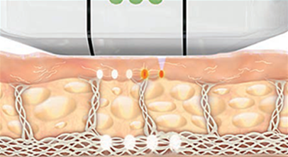  Day of the procedure