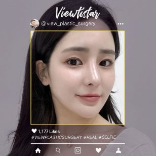 [3 Types Facial Contouring + Rhinoplasty + Fat Graft(Forehead, Cheeks, Temples)] Maeng Jihye | Plastic Surgery Korea