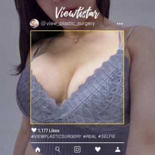 [Breast Augmentation (Motiva)] Maeng Jihye | Plastic Surgery Korea
