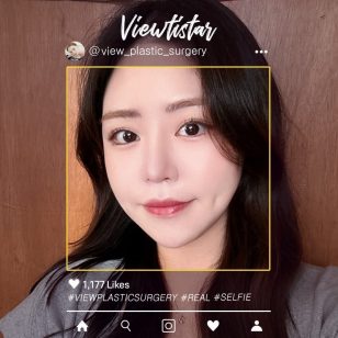 [3 Types Facial Contouring] Lee subin | Plastic Surgery Korea