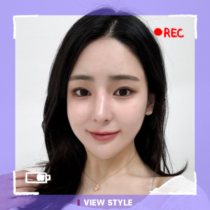 [Rhinoplasty/Contouring/Fat Grafting Surgery] Review of Rhinoplasty, Fat Grafting, and Contouring Surgery at View Plastic Surgery in Korea